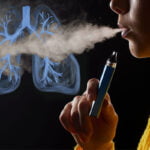 Does Vaping Cause Lung Cancer