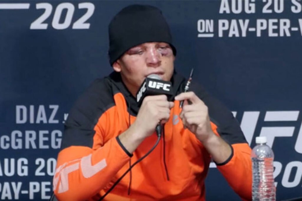 Nate Diaz vaping